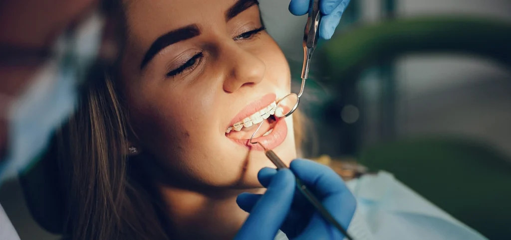 multi-attaches céramique, orthodontiste Strasbourg 67000