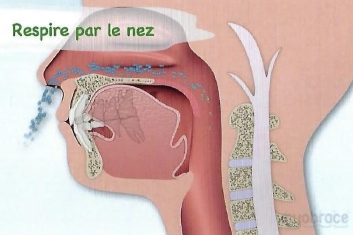 Fiche de ventilation Orthodontiste Strasbourg