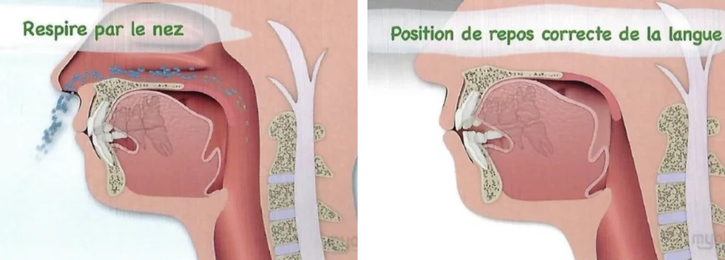 Fiche de ventilation Orthodontiste Strasbourg